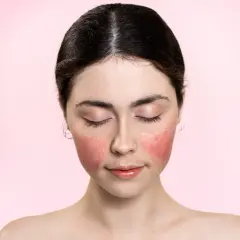 Jeune femme au visage rougi, comme après une coupe rose. Ses yeux sont clos, son expression est douce.