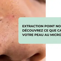 Gros plan sur une peau présentant des points noirs, avec un texte invitant à découvrir ce que cache votre peau au microscope lors de l'extraction de points noirs.
