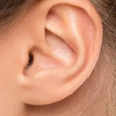 Gros plan sur une oreille humaine, montrant des pores et un petit point noir dans le conduit auditif.