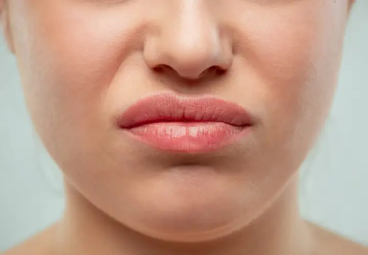 Gros plan sur une bouche pincée, le nez rouge en permanence, la peau légèrement plissée par l'expression.