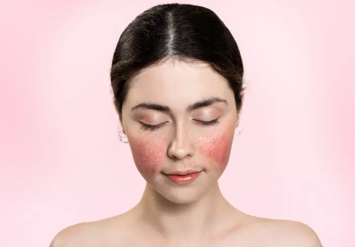 Jeune femme au visage rougi, comme après une coupe rose. Ses yeux sont clos, son expression est douce.