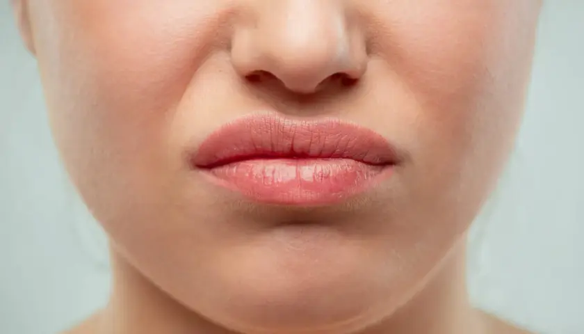 Gros plan sur une bouche pincée, le nez rouge en permanence, la peau légèrement plissée par l'expression.