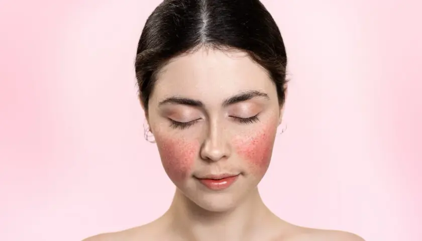Jeune femme au visage rougi, comme après une coupe rose. Ses yeux sont clos, son expression est douce.