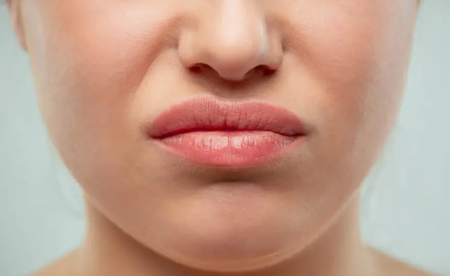 Nez rouge persistant - Causes, soins et quand consulter ?