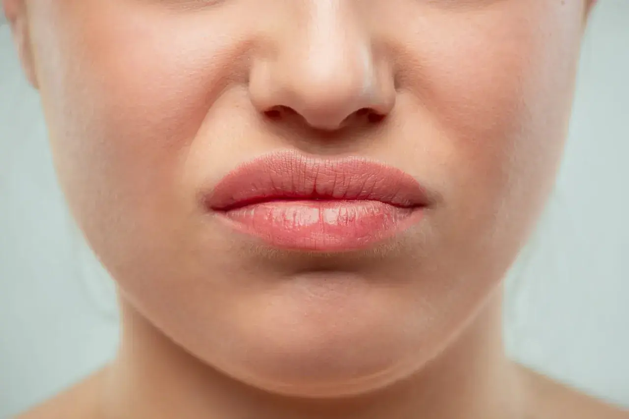 Gros plan sur une bouche pincée, le nez rouge en permanence, la peau légèrement plissée par l'expression.