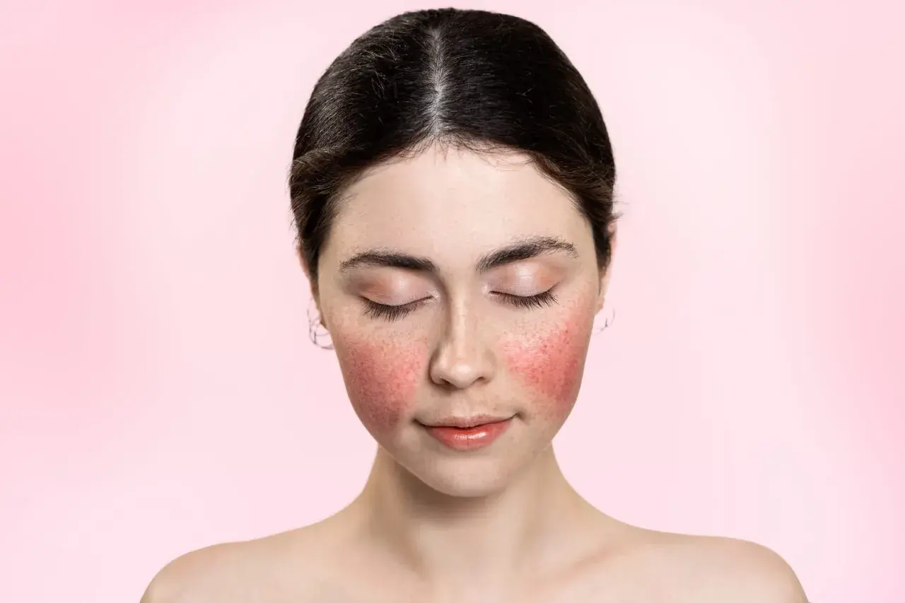 Jeune femme au visage rougi, comme après une coupe rose. Ses yeux sont clos, son expression est douce.