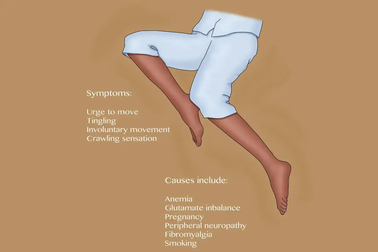 Jambes sans repos : sympt&ocirc;mes et causes. Un rem&egrave;de de grand-m&egrave;re pourrait aider &agrave; soulager ces sensations d&eacute;sagr&eacute;ables.
